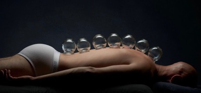 Find out what chinese cupping can do for you